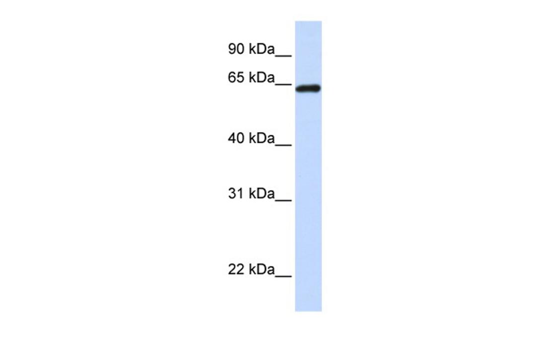 Antibody used in WB on Human Placenta at 0.2-1 ug/ml.