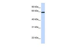 Antibody used in WB on Human Placenta at 0.2-1 ug/ml.