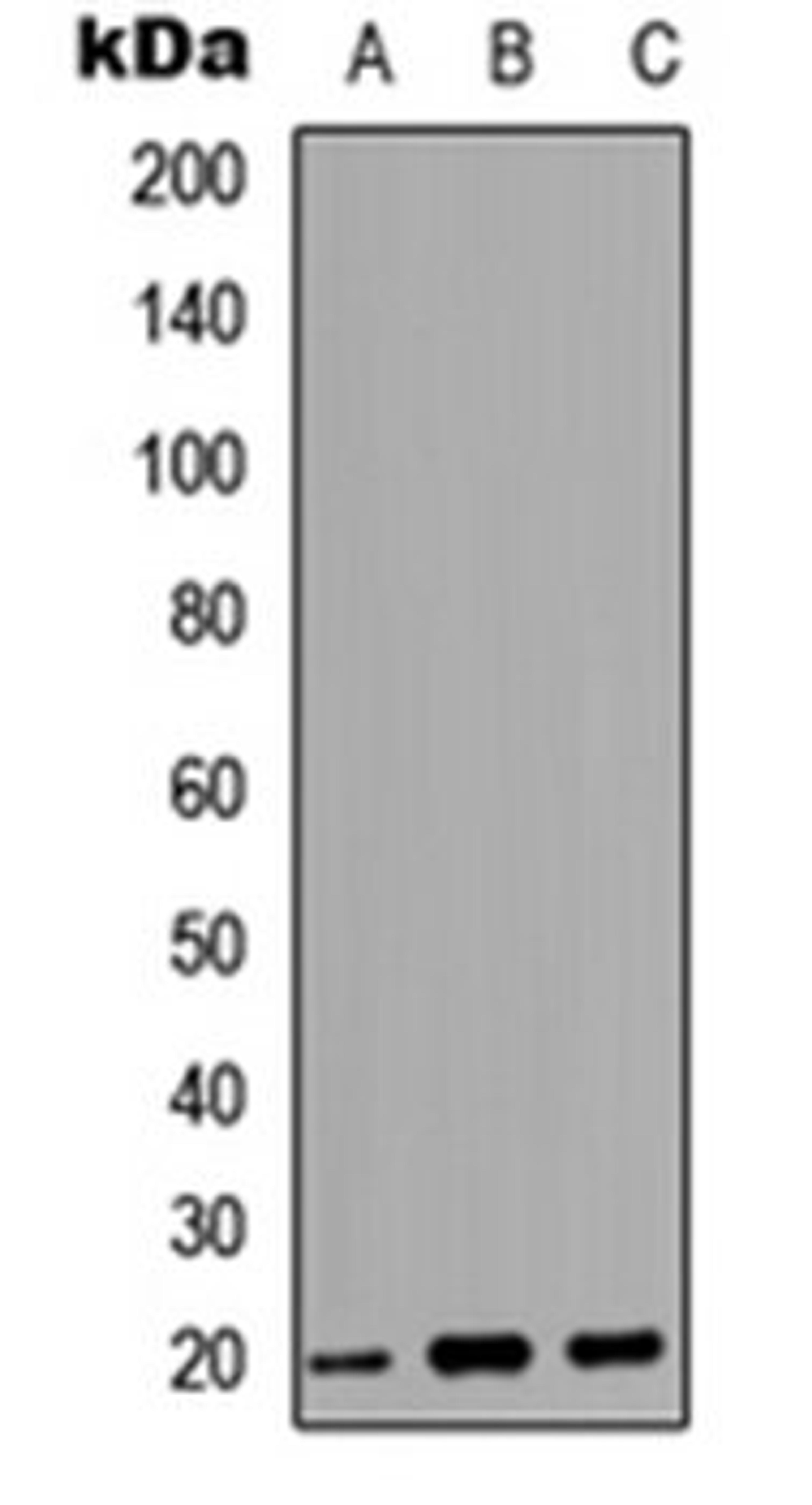 Western blot analysis of HEK293T (Lane 1), Raw264.7 (Lane 2), PC12 (Lane 3) whole cell lysates using MRP antibody