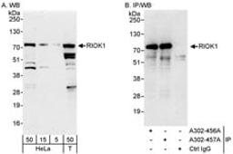 Detection of human RIOK1 by western blot and immunoprecipitation.