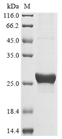 (Tris-Glycine gel) Discontinuous SDS-PAGE (reduced) with 5% enrichment gel and 15% separation gel.