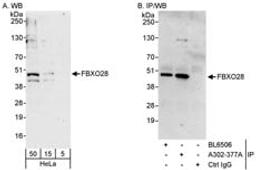 Detection of human FBXO28 by western blot and immunoprecipitation.