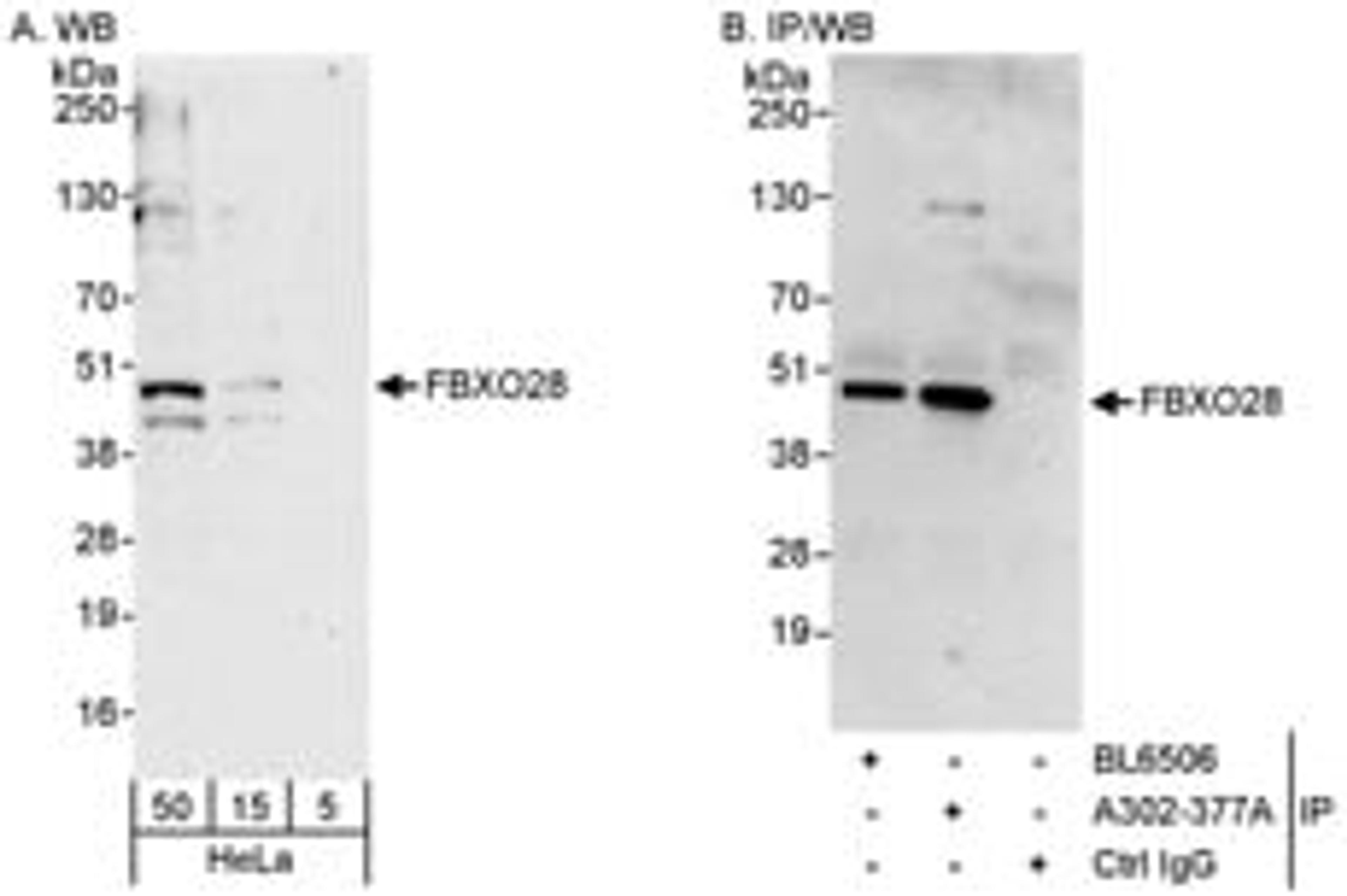 Detection of human FBXO28 by western blot and immunoprecipitation.