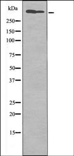 Western blot analysis of MDA-MB-435 whole cell lysates using DNA-PK -Phospho-Ser2612- antibody