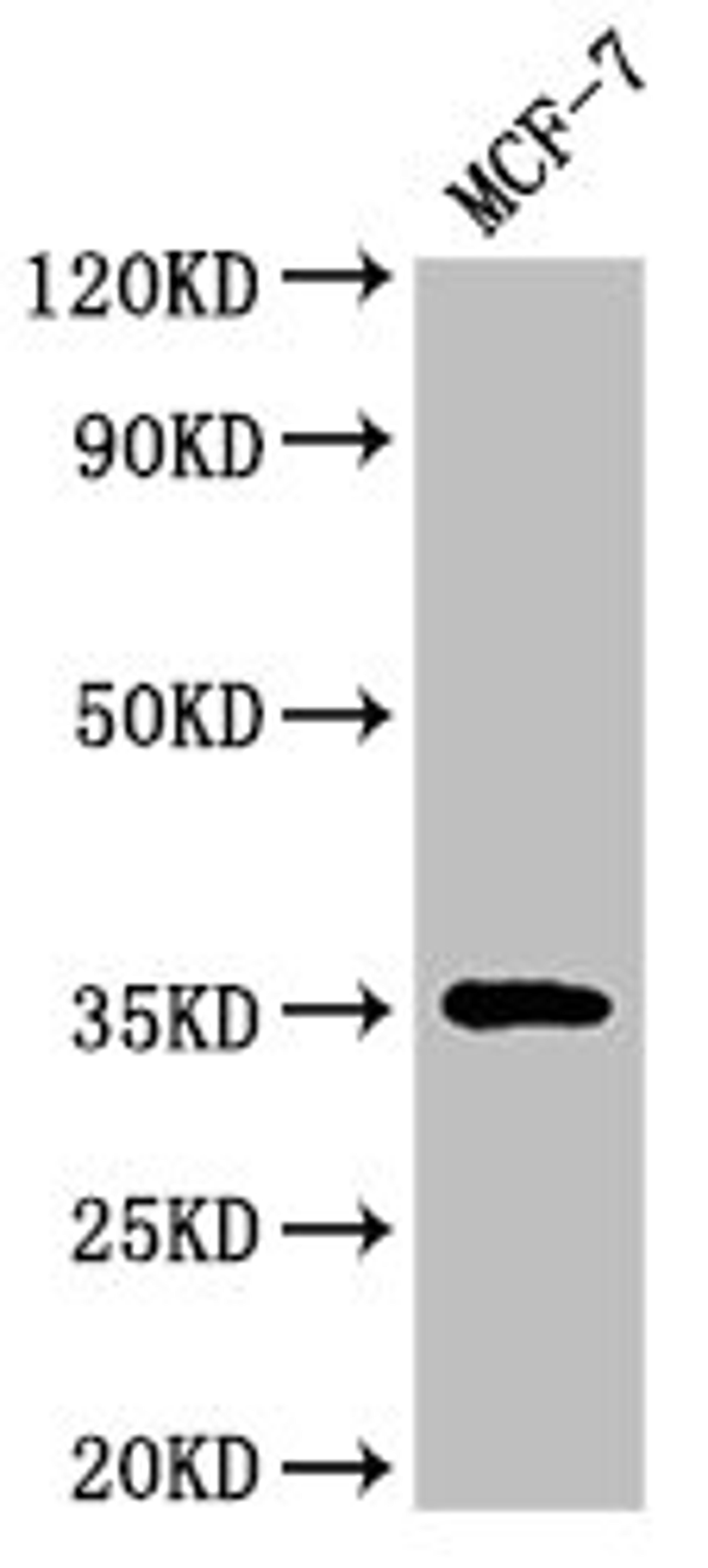Western Blot. Positive WB detected in: MCF-7 whole cell lysate. All lanes: ACY3 antibody at 3ug/ml. Secondary. Goat polyclonal to rabbit IgG at 1/50000 dilution. Predicted band size: 36 kDa. Observed band size: 36 kDa.