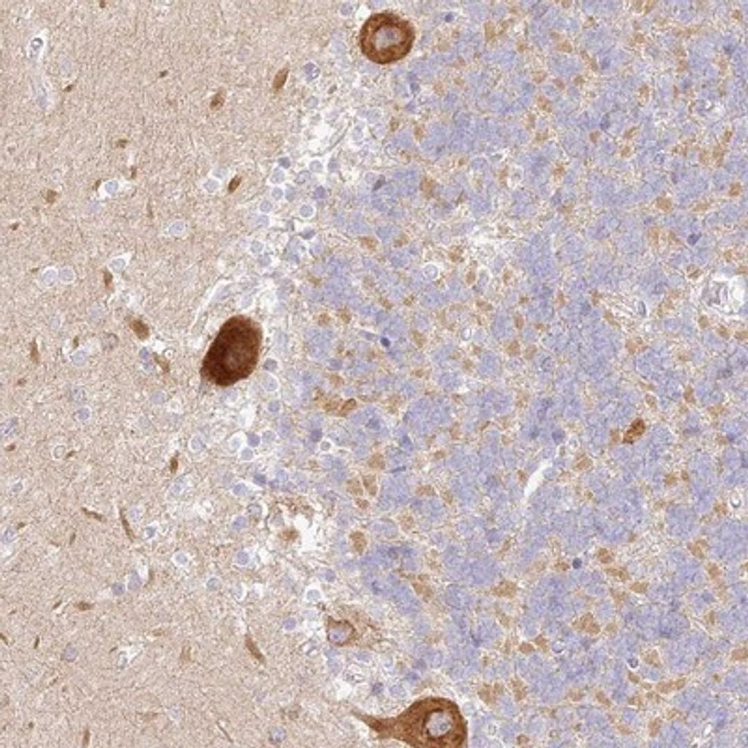 Immunohistochemistry-Paraffin: LRRC15 Antibody [NBP1-93556] - Immunohistochemical staining of human cerebellum shows strong cytoplasmic positivity in Purkinje cells.