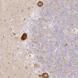 Immunohistochemistry-Paraffin: LRRC15 Antibody [NBP1-93556] - Immunohistochemical staining of human cerebellum shows strong cytoplasmic positivity in Purkinje cells.