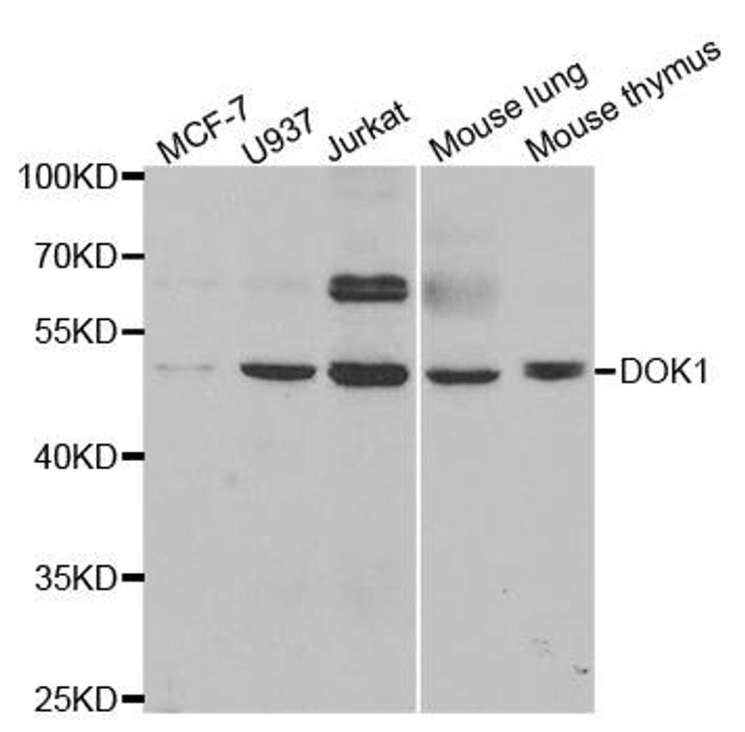 Western blot analysis of extracts of various cell lines using DOK1 antibody