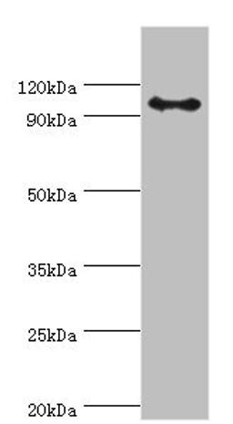 Western blot. All lanes: AP-2 complex subunit beta antibody at 8ug/ml + Mouse brain tissue. Secondary. Goat polyclonal to rabbit IgG at 1/10000 dilution. Predicted band size: 105, 106, 99 kDa. Observed band size: 105 kDa.