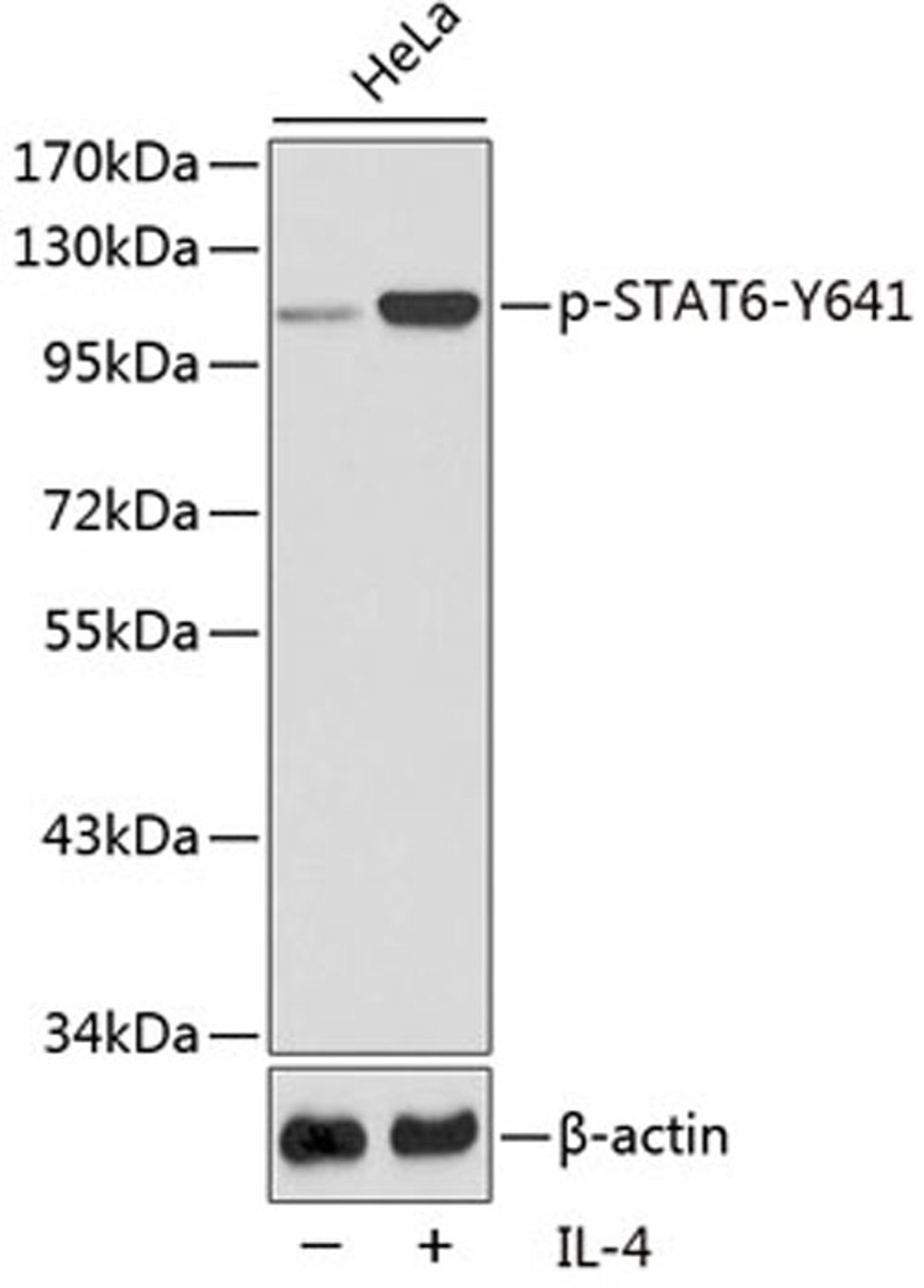 Western blot - Phospho-STAT6-Y641 antibody (AP0456)