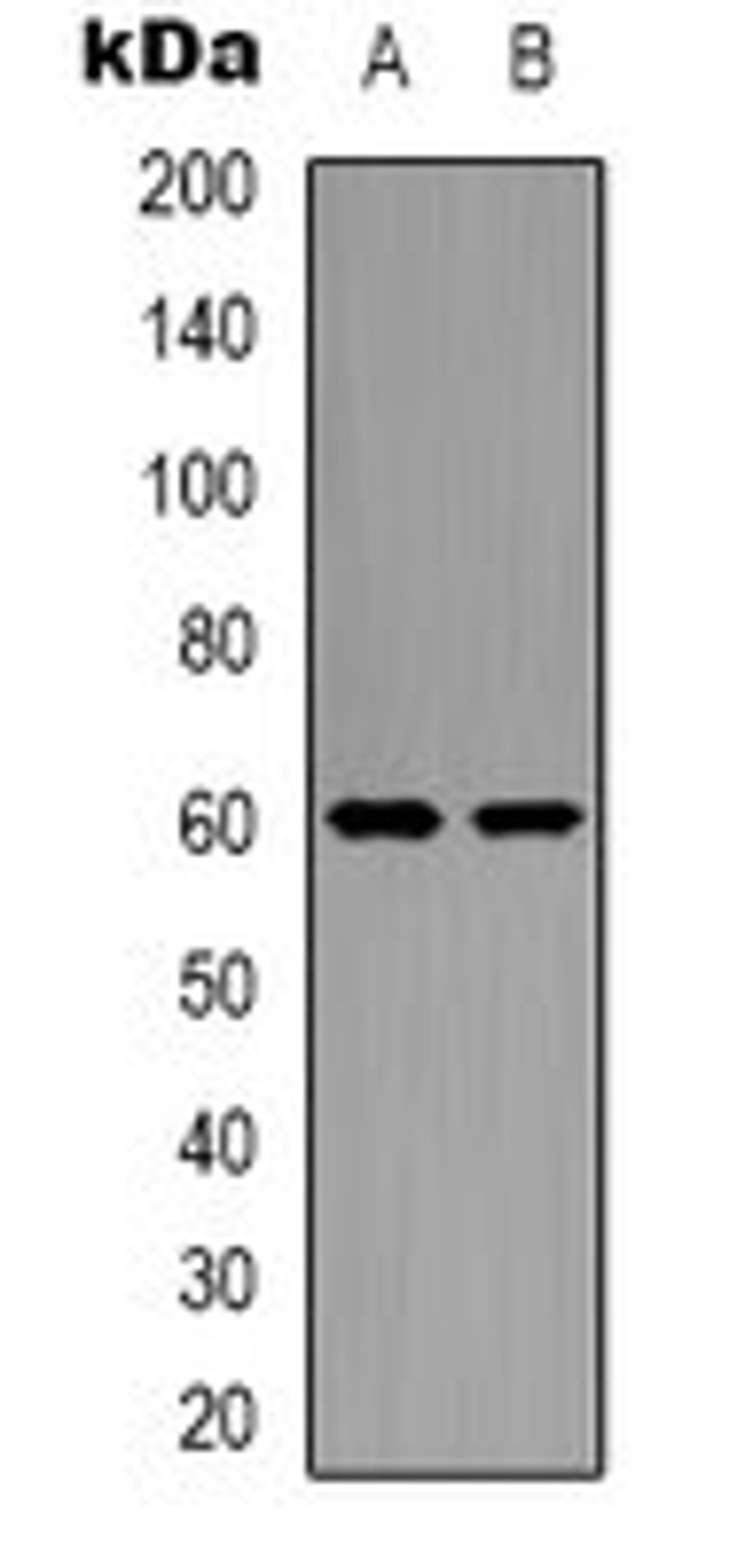 Western blot analysis of NIH3T3 (Lane 1), K562 (Lane 2) whole cell lysates using GRB10 antibody