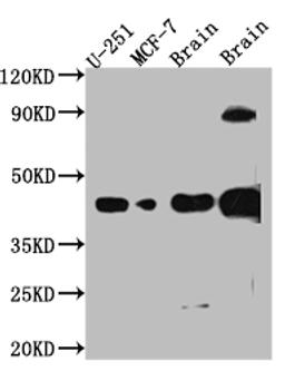 Western Blot. Positive WB detected in: U-251 whole cell lysate, MCF-7 whole cell lysate, Mouse Brain whole cell lysate, Rat Brain whole cell lysate. All lanes: SOX2 antibody at 1:1000. Secondary. Goat polyclonal to rabbit IgG at 1/50000 dilution. Predicted band size: 35 kDa. Observed band size: 40 kDa.