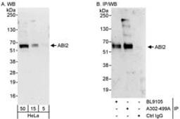 Detection of human ABI2 by western blot and immunoprecipitation.