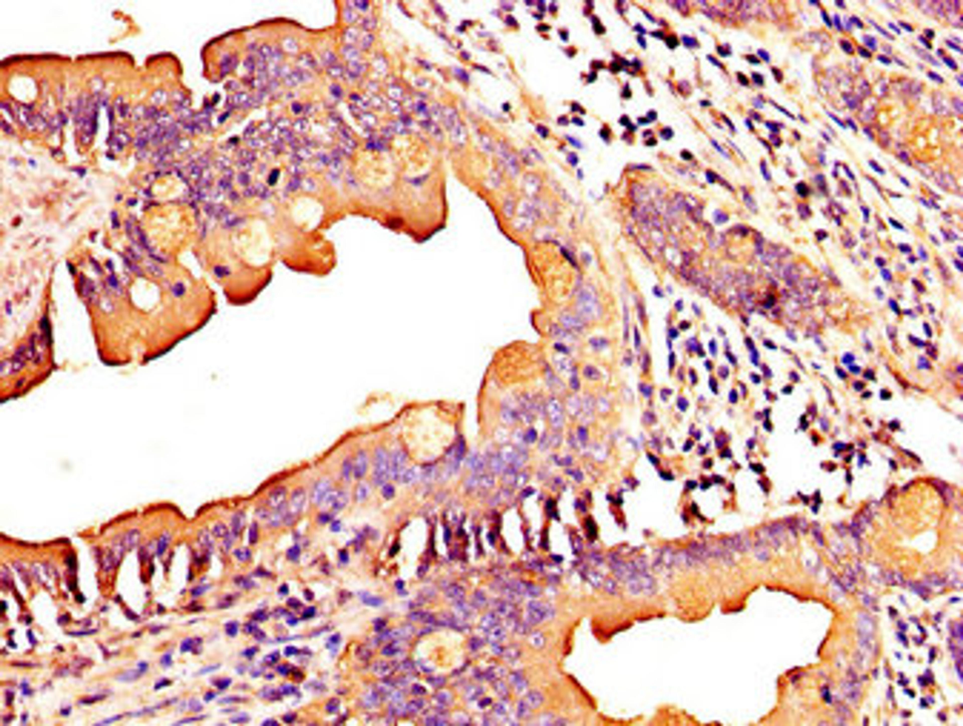 IHC image of CSB-PA873607LA01HU diluted at 1:300 and staining in paraffin-embedded human small intestine tissue performed on a Leica BondTM system. After dewaxing and hydration, antigen retrieval was mediated by high pressure in a citrate buffer (pH 6.0). Section was blocked with 10% normal goat serum 30min at RT. Then primary antibody (1% BSA) was incubated at 4&deg;C overnight. The primary is detected by a biotinylated secondary antibody and visualized using an HRP conjugated SP system.