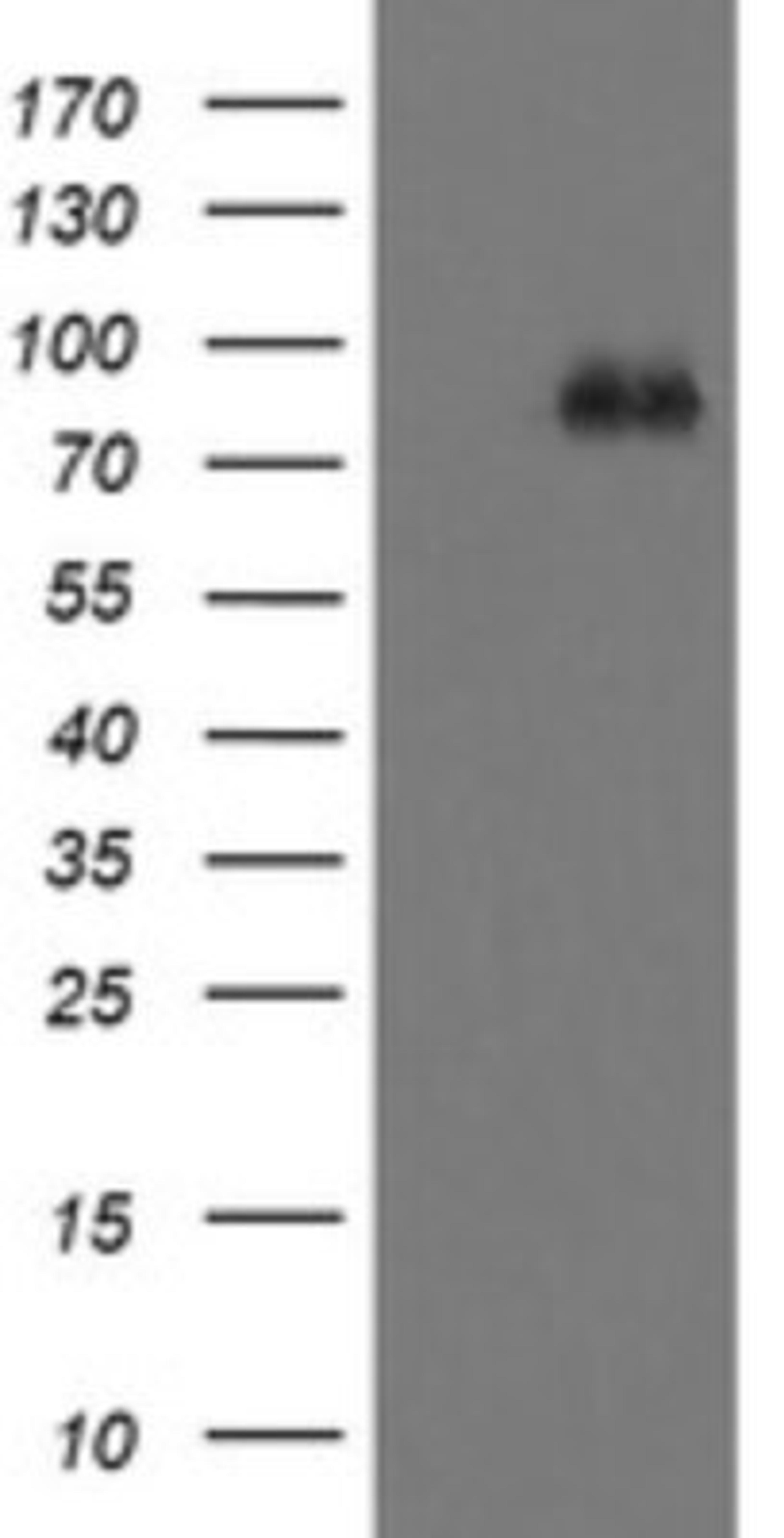 Western Blot: FBXO42 Antibody (1H4) [NBP2-45621] - Analysis of HEK293T cells were transfected with the pCMV6-ENTRY control (Left lane) or pCMV6-ENTRY FBXO42.