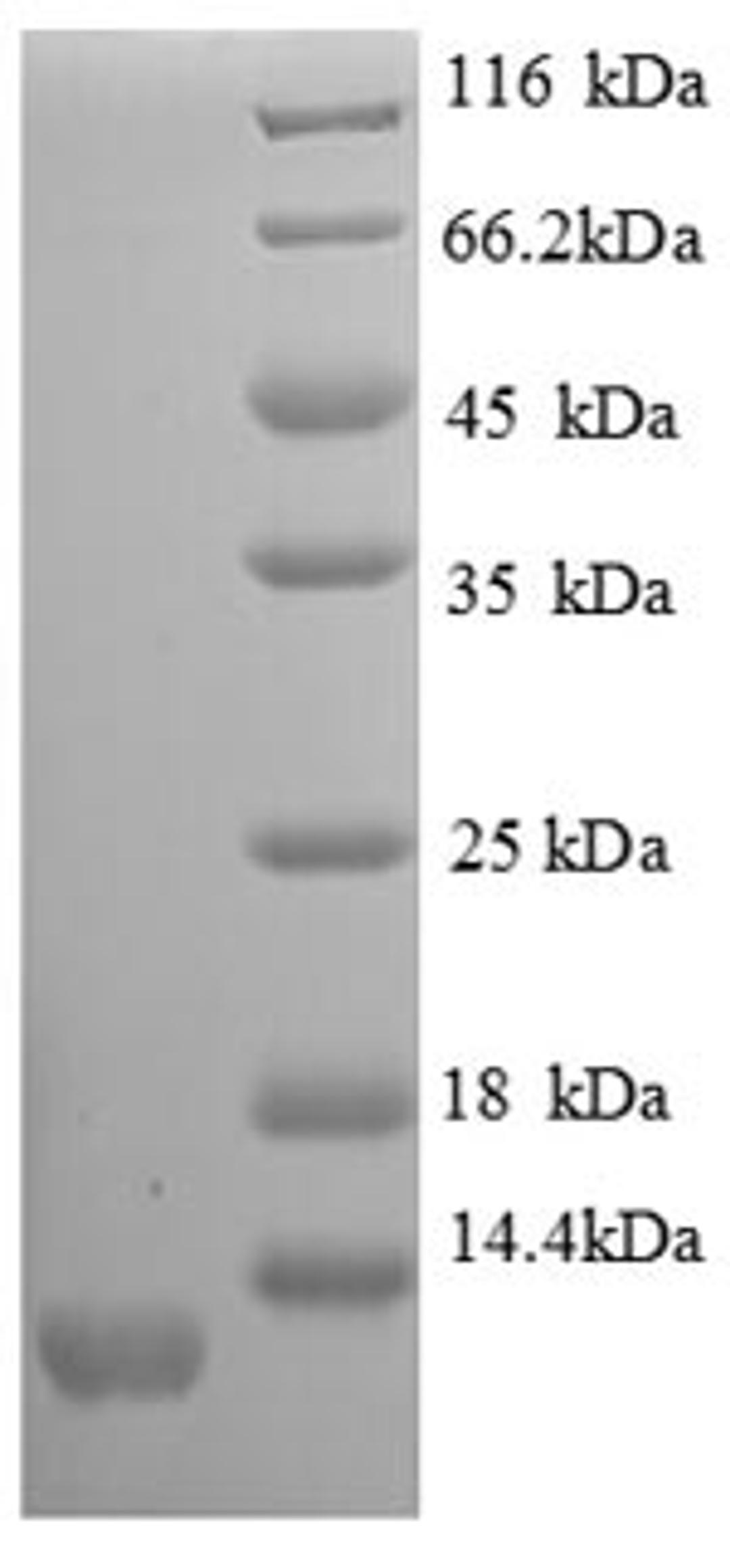 (Tris-Glycine gel) Discontinuous SDS-PAGE (reduced) with 5% enrichment gel and 15% separation gel.