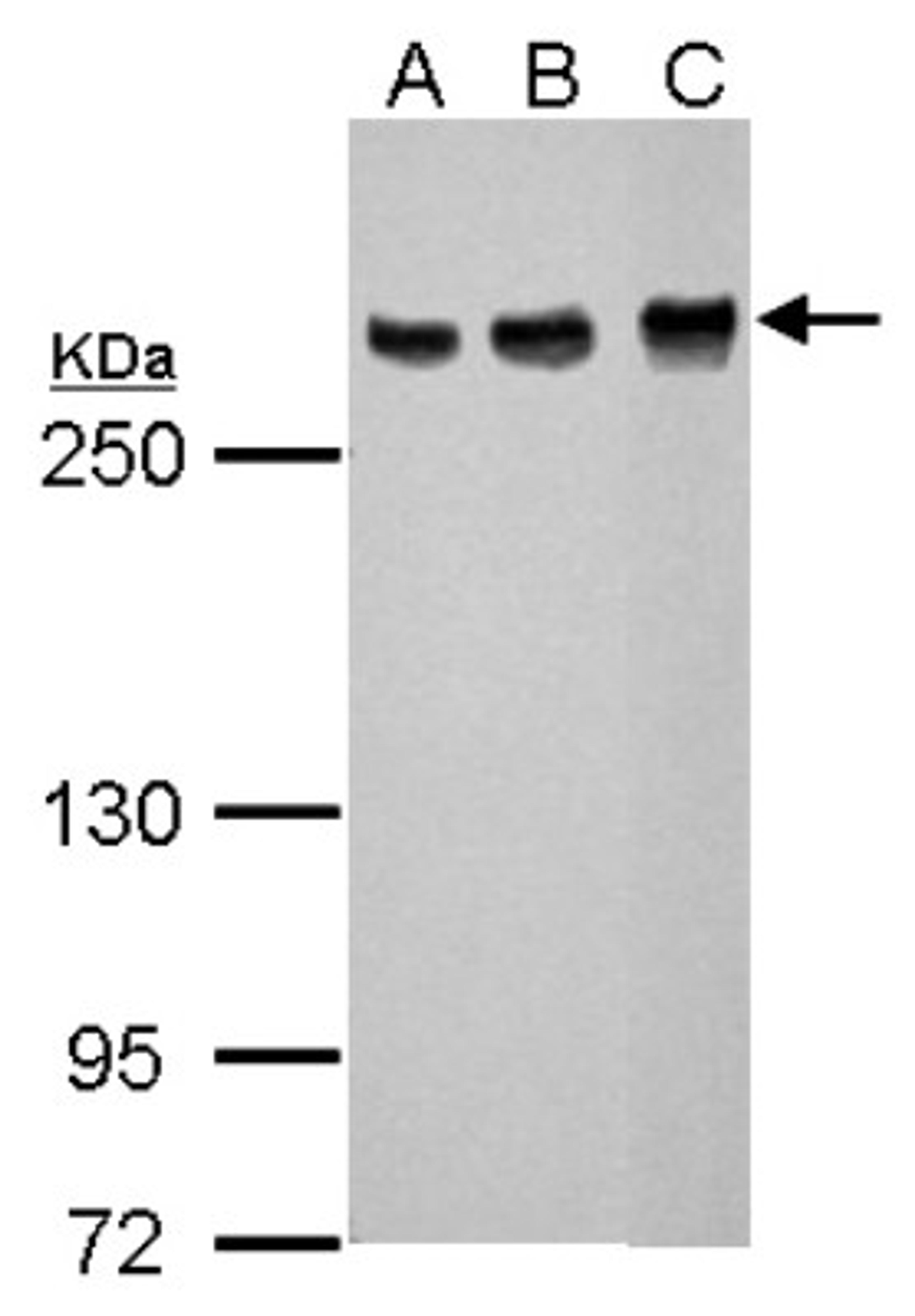 Western Blot: ATM Antibody (2C1) [NB100-309] - A. 30 ug NT2D1 whole cell lysate/extract, B: 30 ug PC-3 whole cell lysate/extract, C: 30 ug SK-NSh whole cell lysate/extract 5% SDS-PAGE, antibody dilution 1:1000.