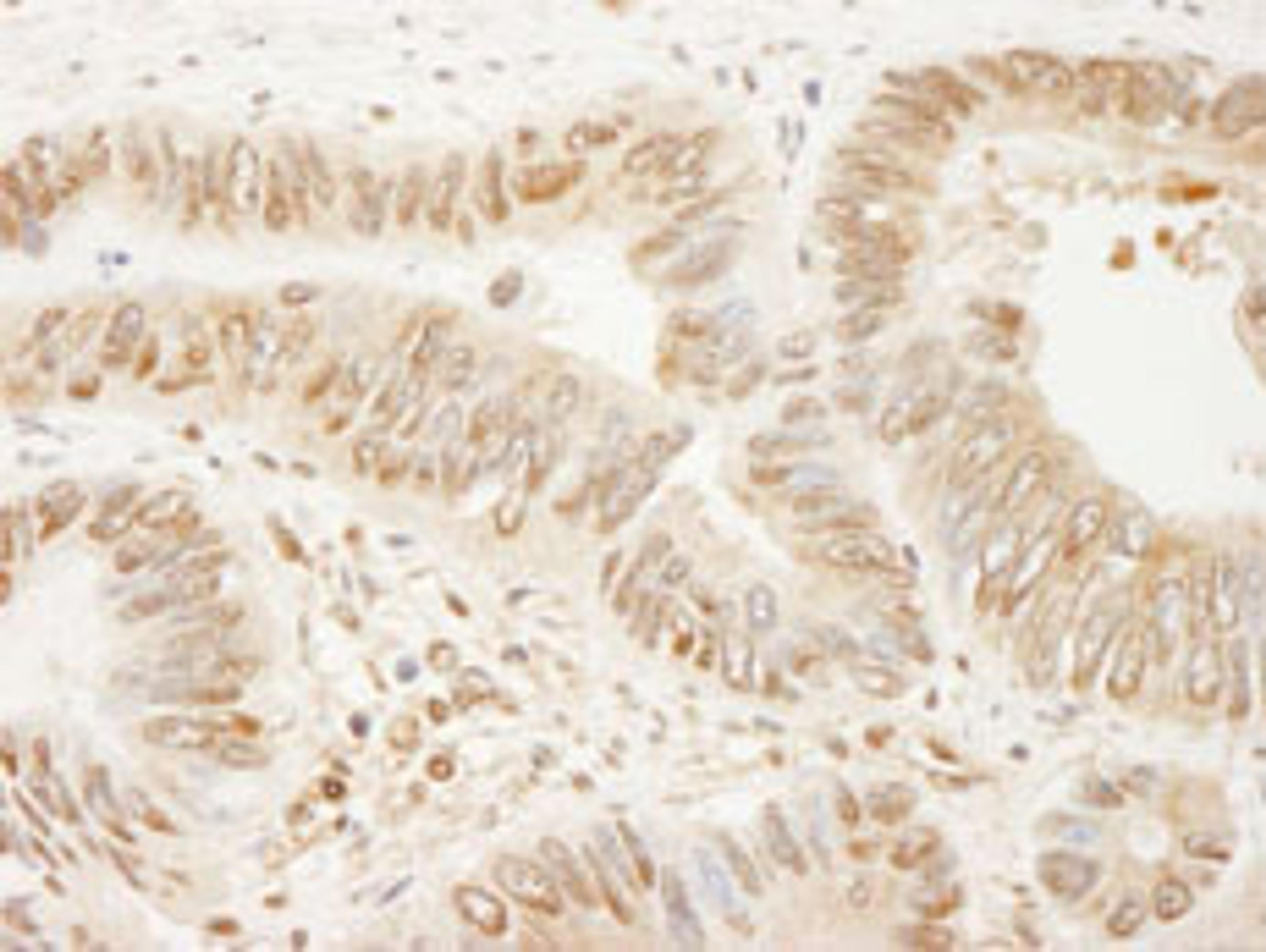 Detection of human SSH3 by immunohistochemistry.