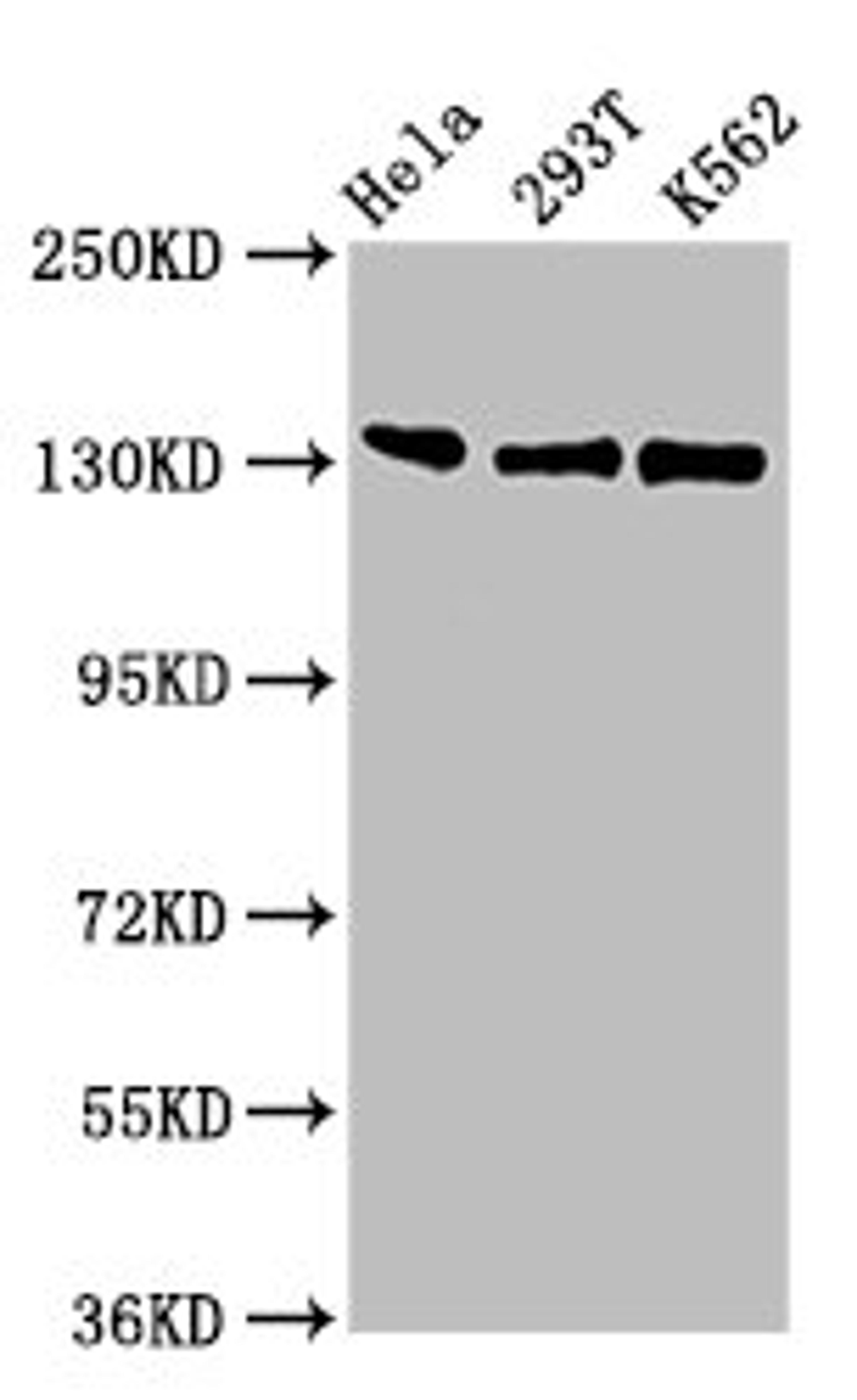 Western Blot. Positive WB detected in: Hela whole cell lysate, 293T whole cell lysate, K562 whole cell lysate. All lanes: RFX1 antibody at 3ug/ml. Secondary. Goat polyclonal to rabbit IgG at 1/50000 dilution. Predicted band size: 105 kDa. Observed band size: 105 kDa. 