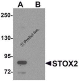 Western blot analysis of STOX2 in human kidney tissue lysate with STOX2 antibody at 1 μg/mL in (A) the absence and (B) the presence of blocking peptide.
