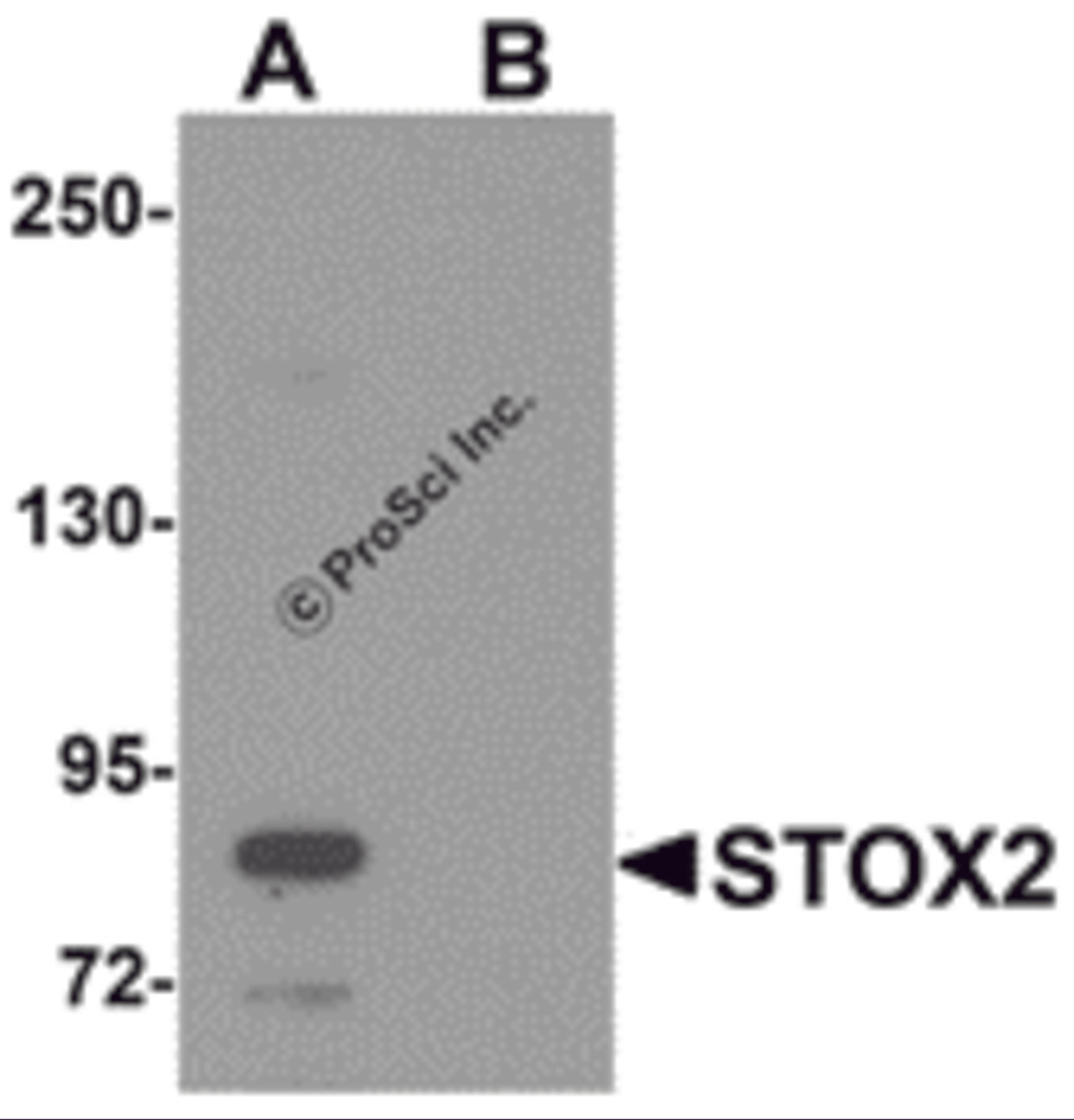 Western blot analysis of STOX2 in human kidney tissue lysate with STOX2 antibody at 1 μg/mL in (A) the absence and (B) the presence of blocking peptide.