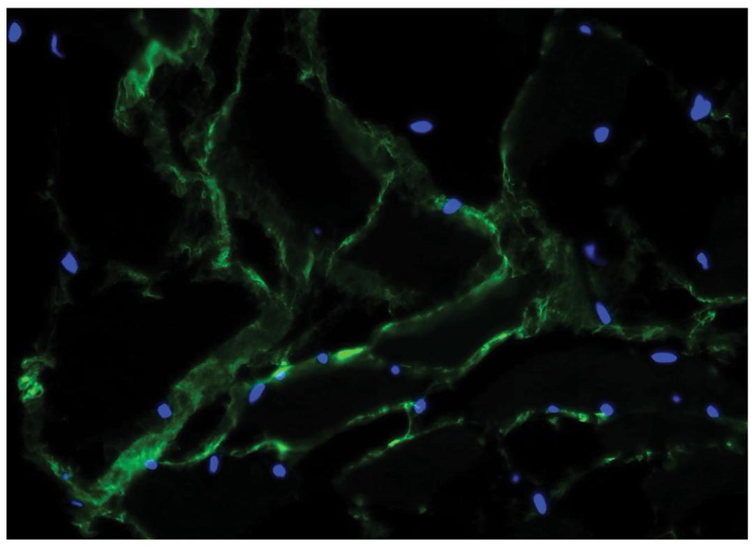 Bovine muscle tissue was stained with Mouse Anti-Fibrillin-UNLB (Cat. No. 98-519) followed by Goat Anti-Mouse IgG1, Human ads-FITC .