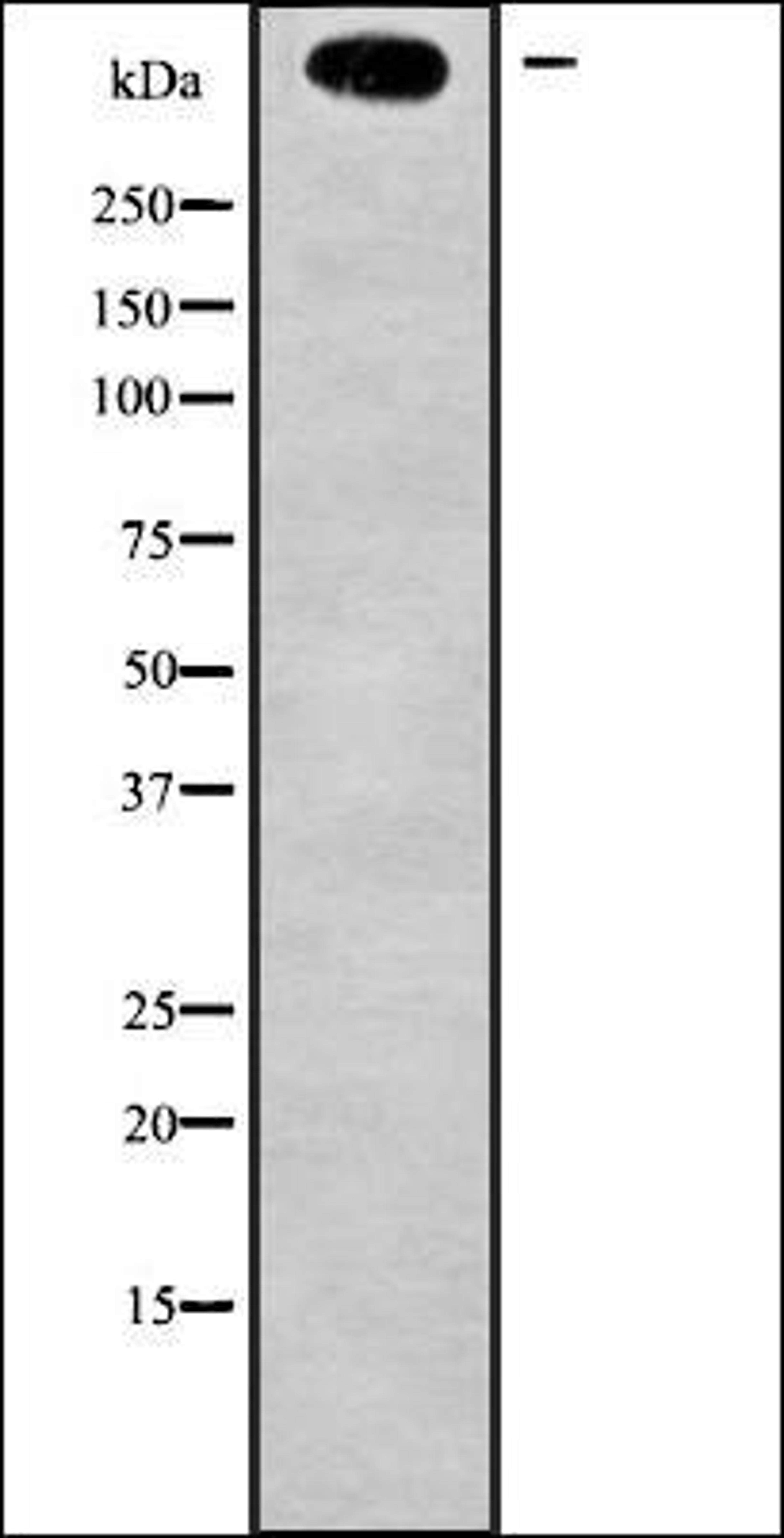 Western blot analysis of Jurkat whole cell lysates using MLL2 antibody