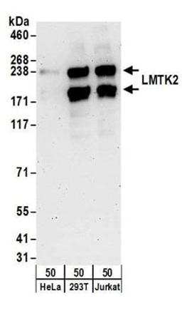 Detection of human LMTK2 by western blot.