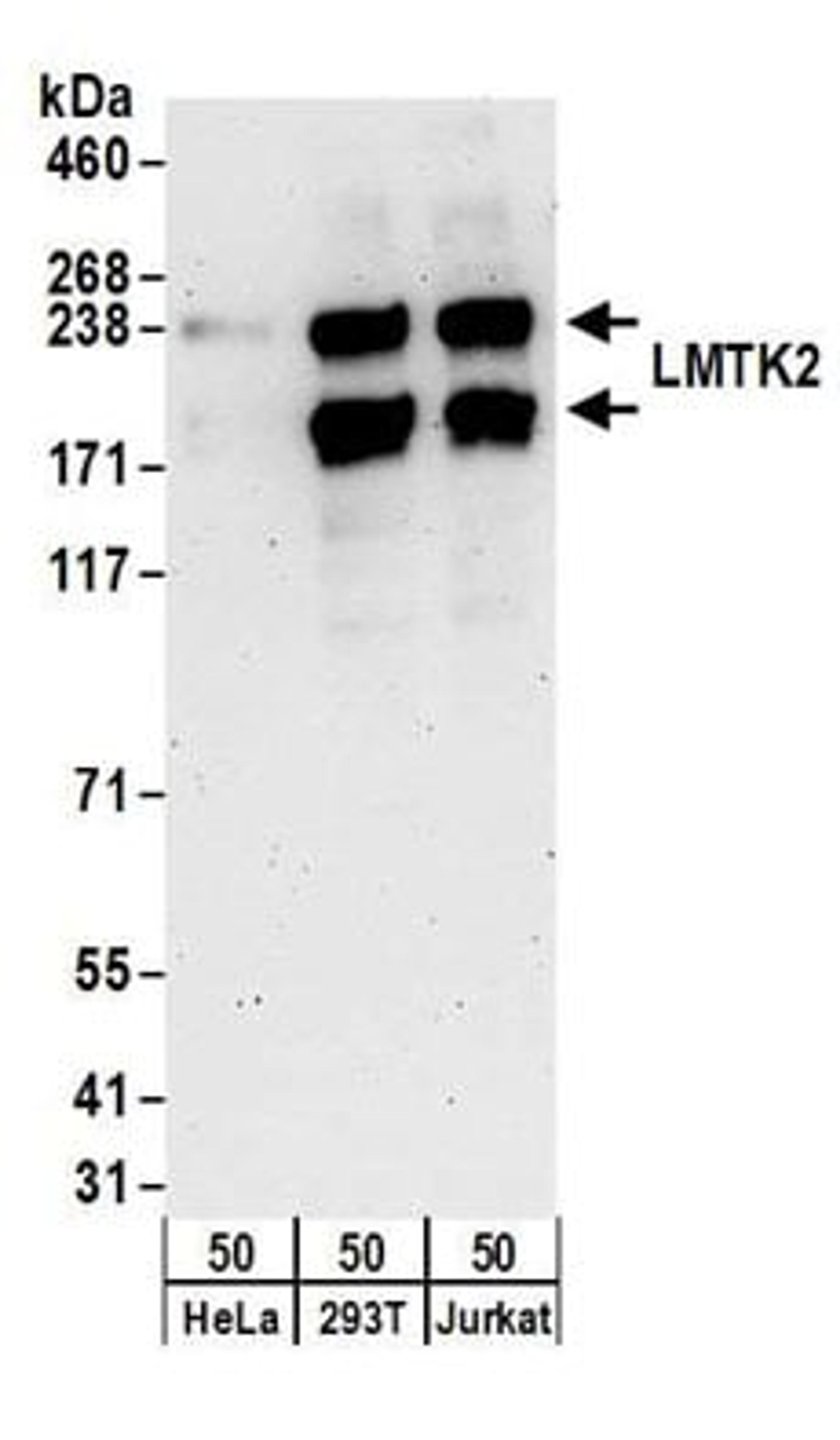 Detection of human LMTK2 by western blot.