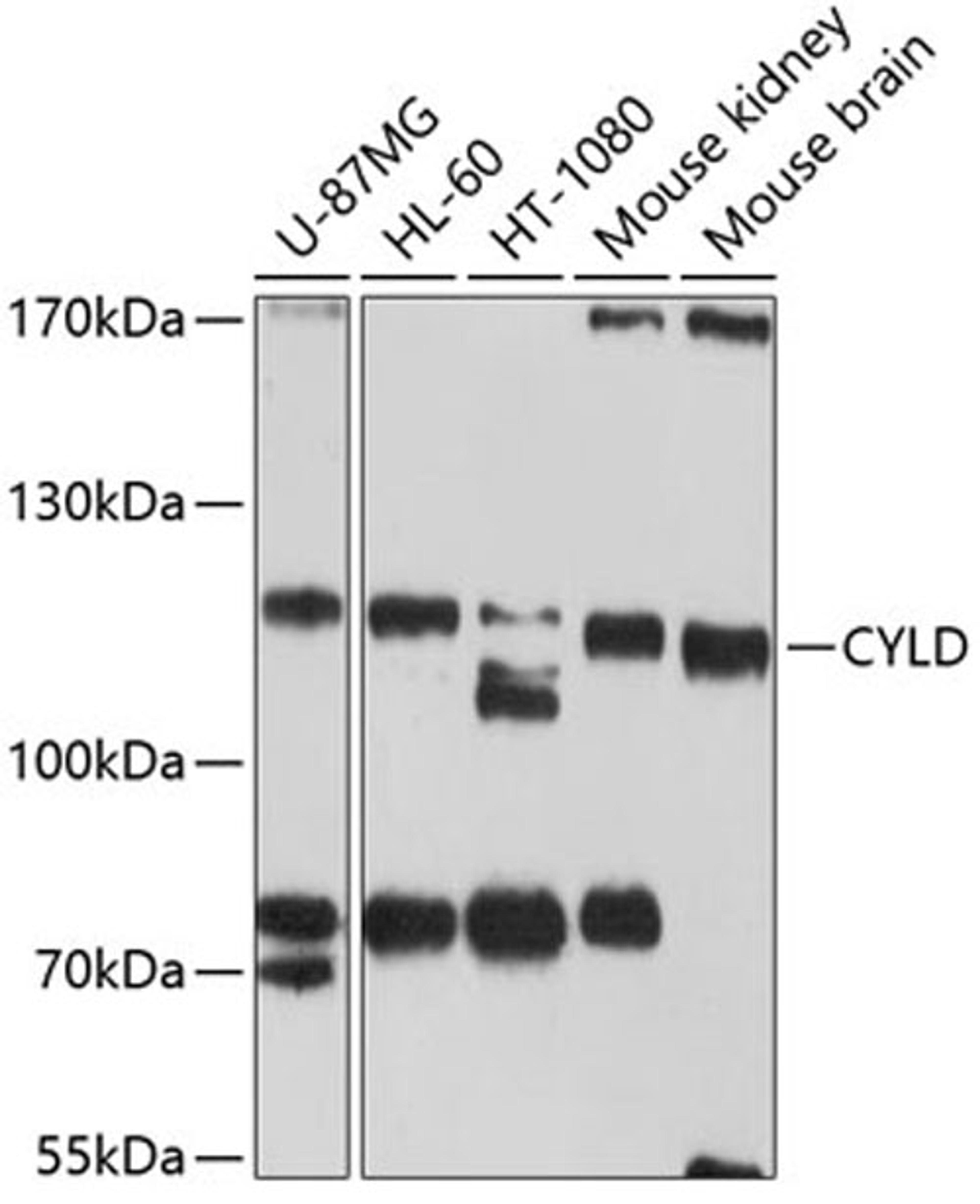 Western blot - CYLD antibody (A3821)