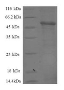 (Tris-Glycine gel) Discontinuous SDS-PAGE (reduced) with 5% enrichment gel and 15% separation gel.