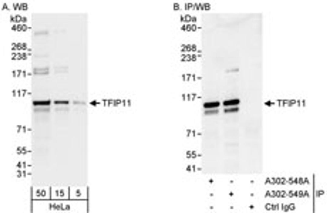 Detection of human TFIP11 by western blot and immunoprecipitation.