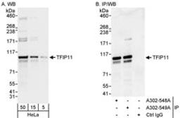 Detection of human TFIP11 by western blot and immunoprecipitation.