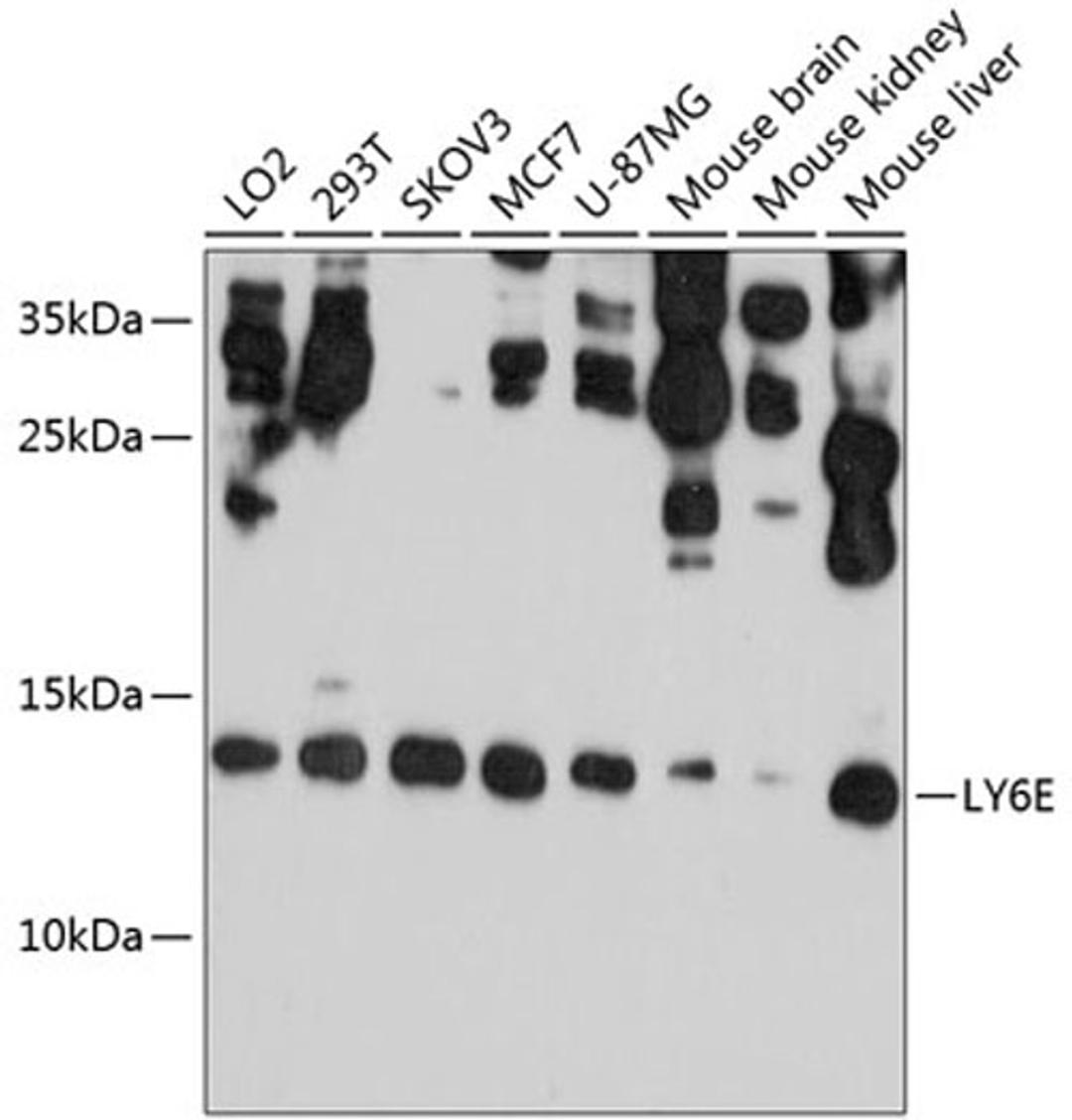 Western blot - LY6E antibody (A10225)