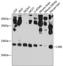 Western blot - LY6E antibody (A10225)