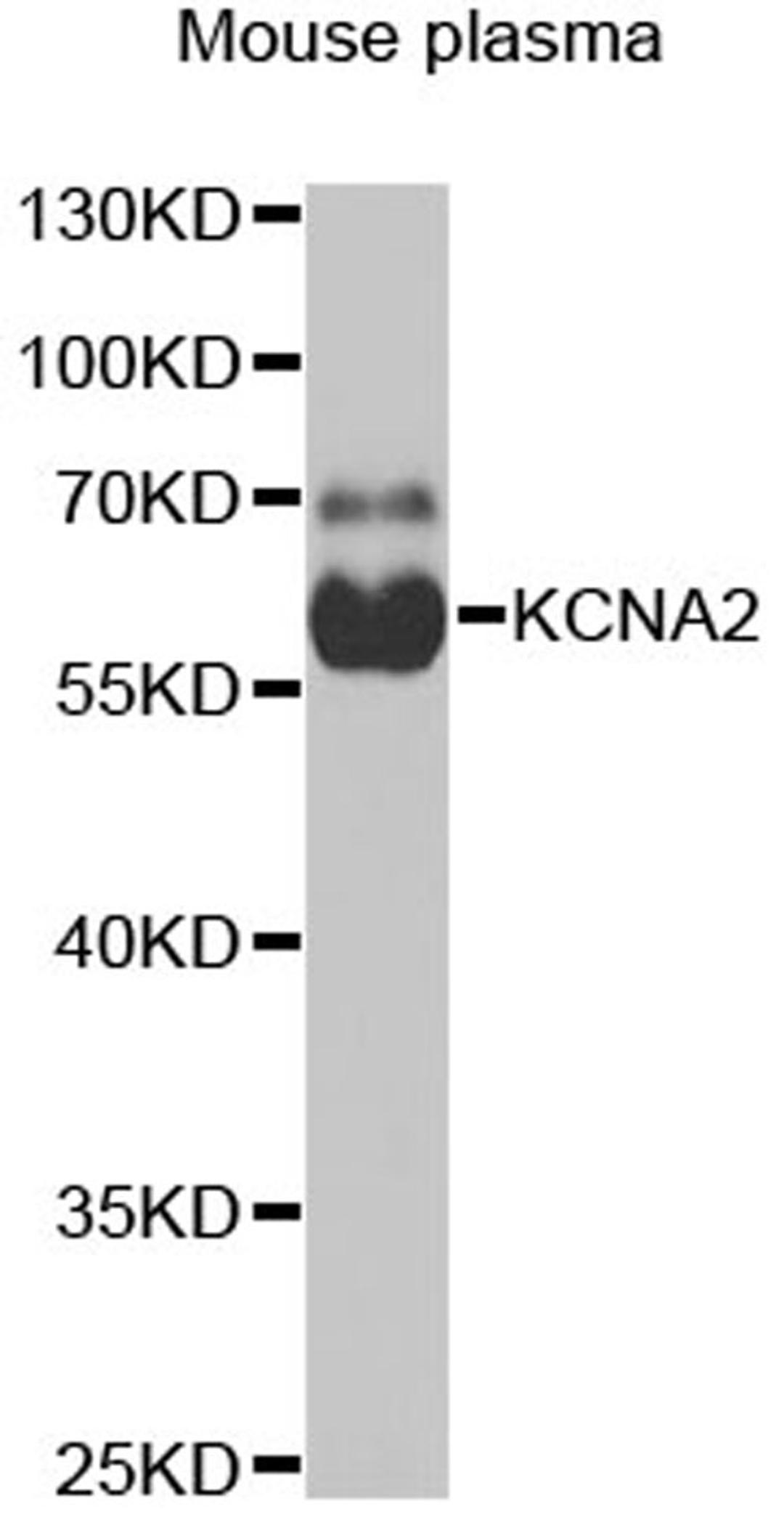 Western blot - KCNA2 antibody (A6295)