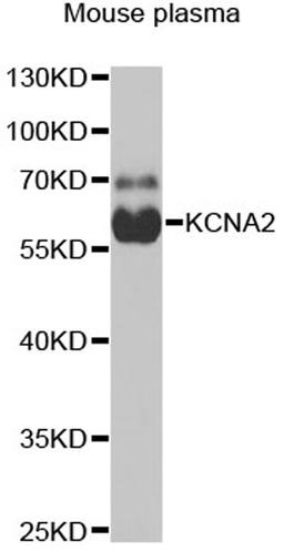 Western blot - KCNA2 antibody (A6295)