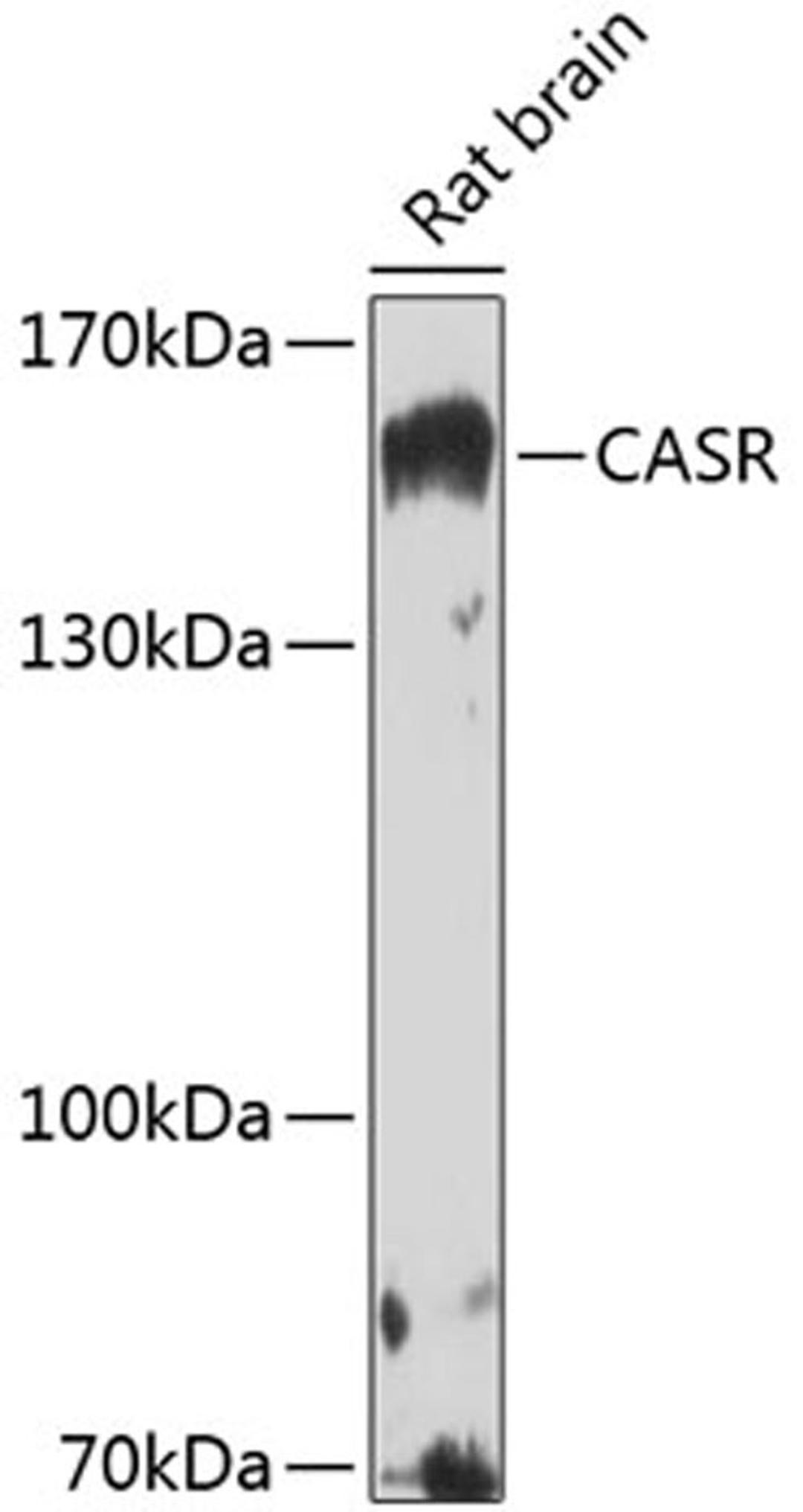 Western blot - CASR antibody (A13000)