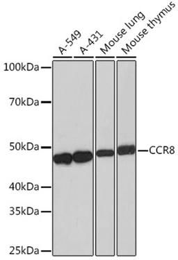 Western blot - CCR8 Rabbit mAb (A4288)