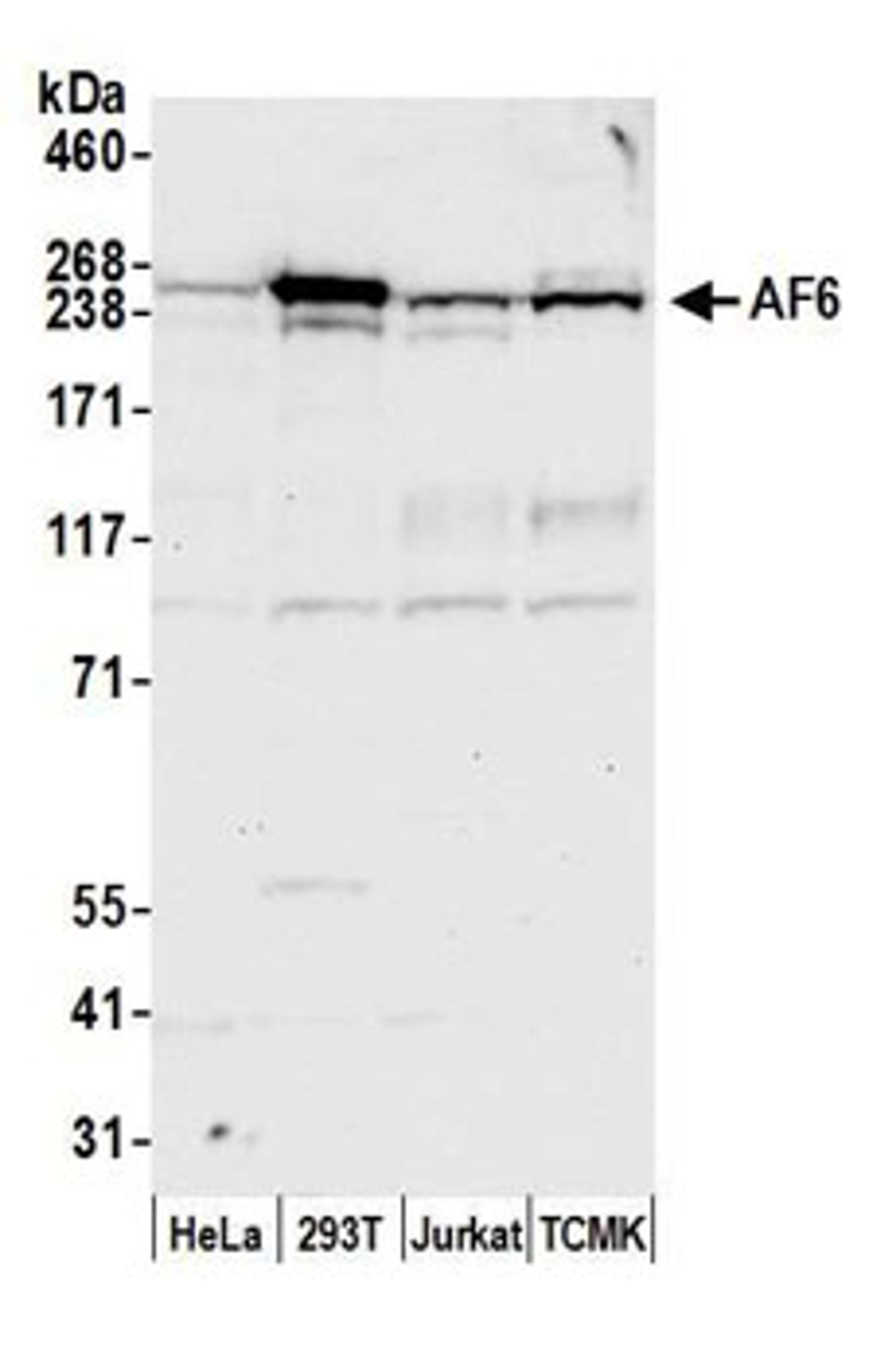 Detection of human and mouse AF6 by western blot.