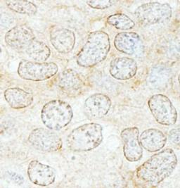 Detection of human NUP50 by immunohistochemistry.