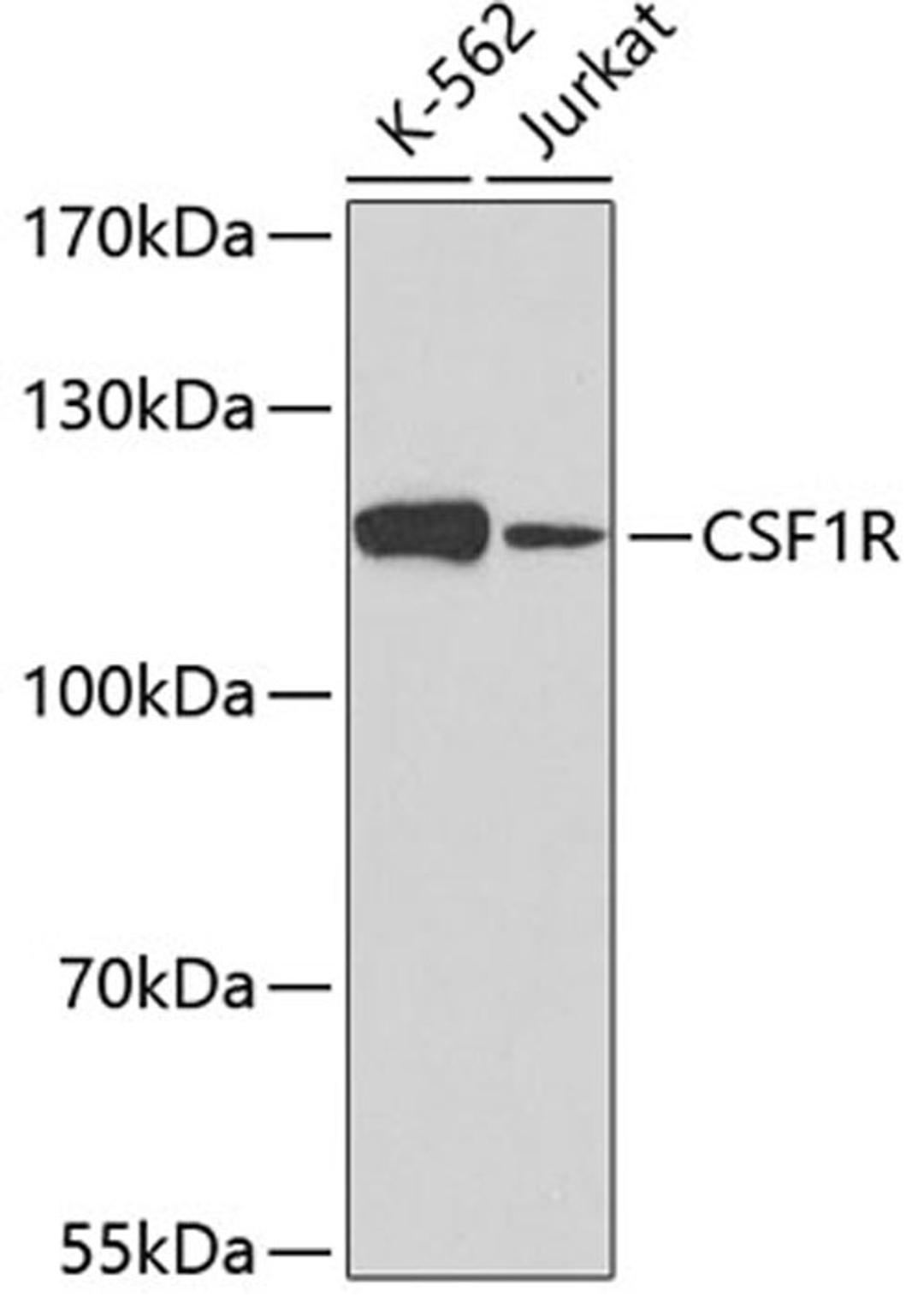 Western blot - CSF1R antibody (A3019)