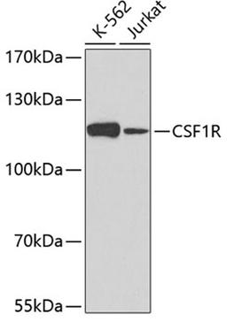 Western blot - CSF1R antibody (A3019)