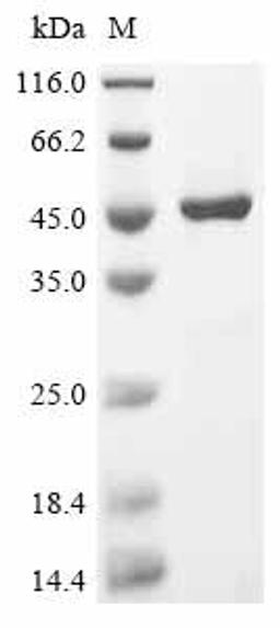 (Tris-Glycine gel) Discontinuous SDS-PAGE (reduced) with 5% enrichment gel and 15% separation gel.