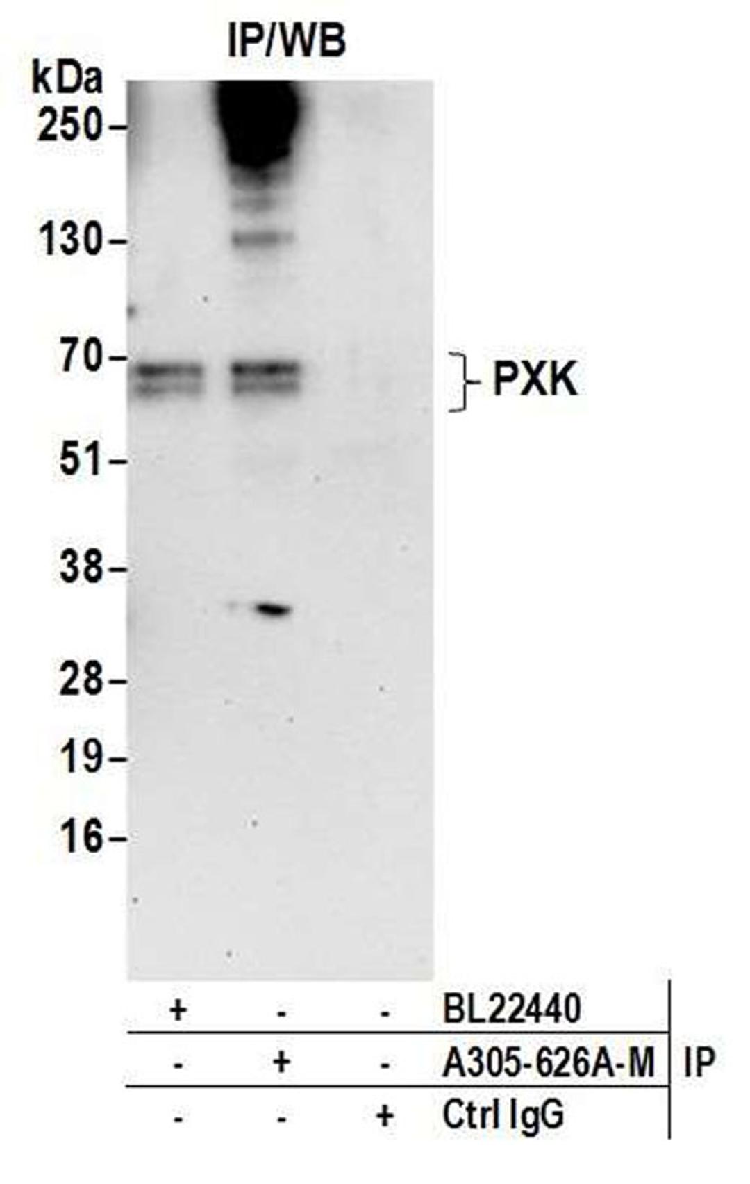 Detection of human PXK by WB of IP.