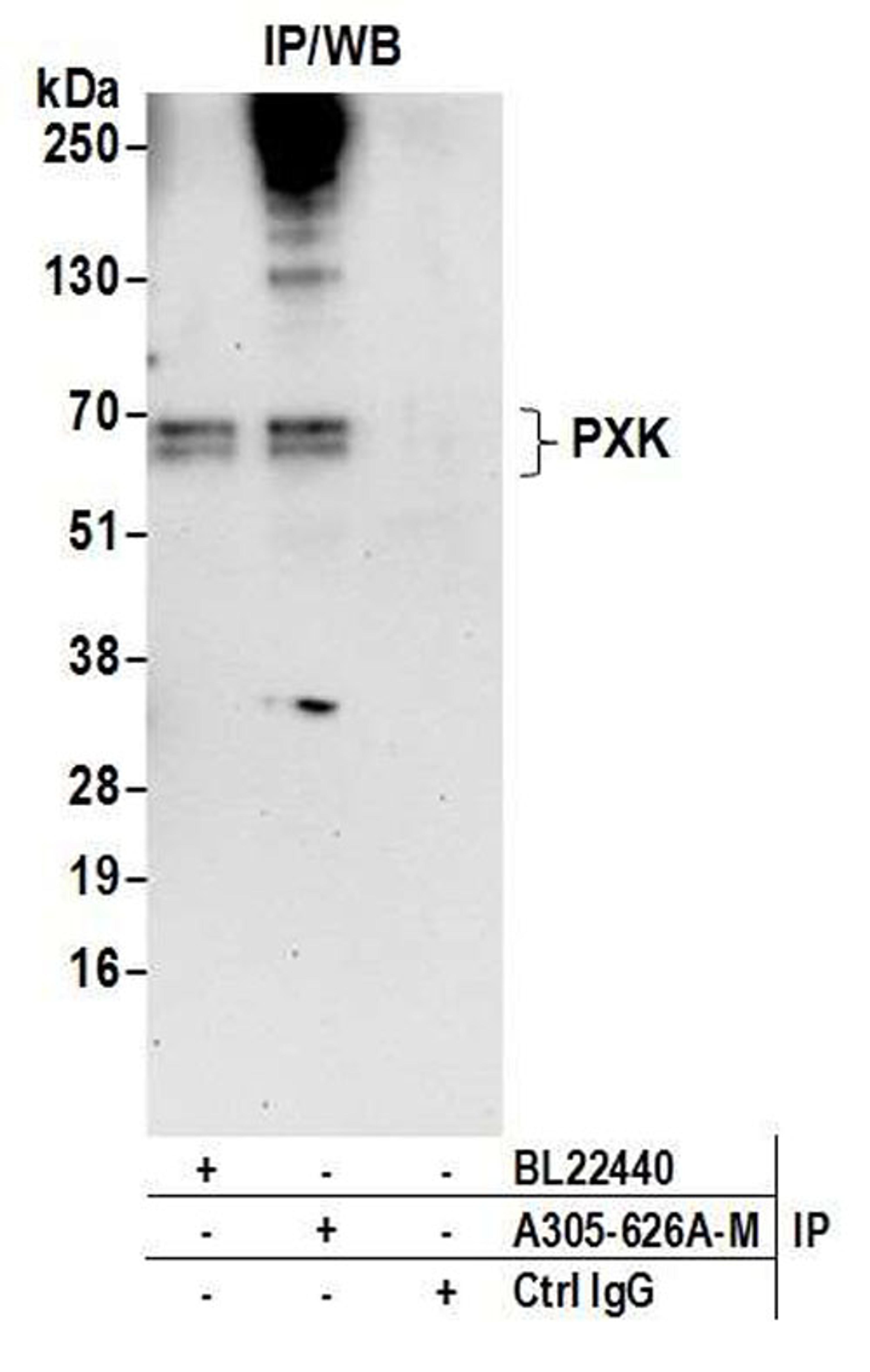 Detection of human PXK by WB of IP.