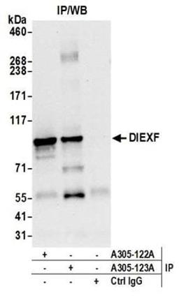 Detection of human DIEXF by western blot of immunoprecipitates.