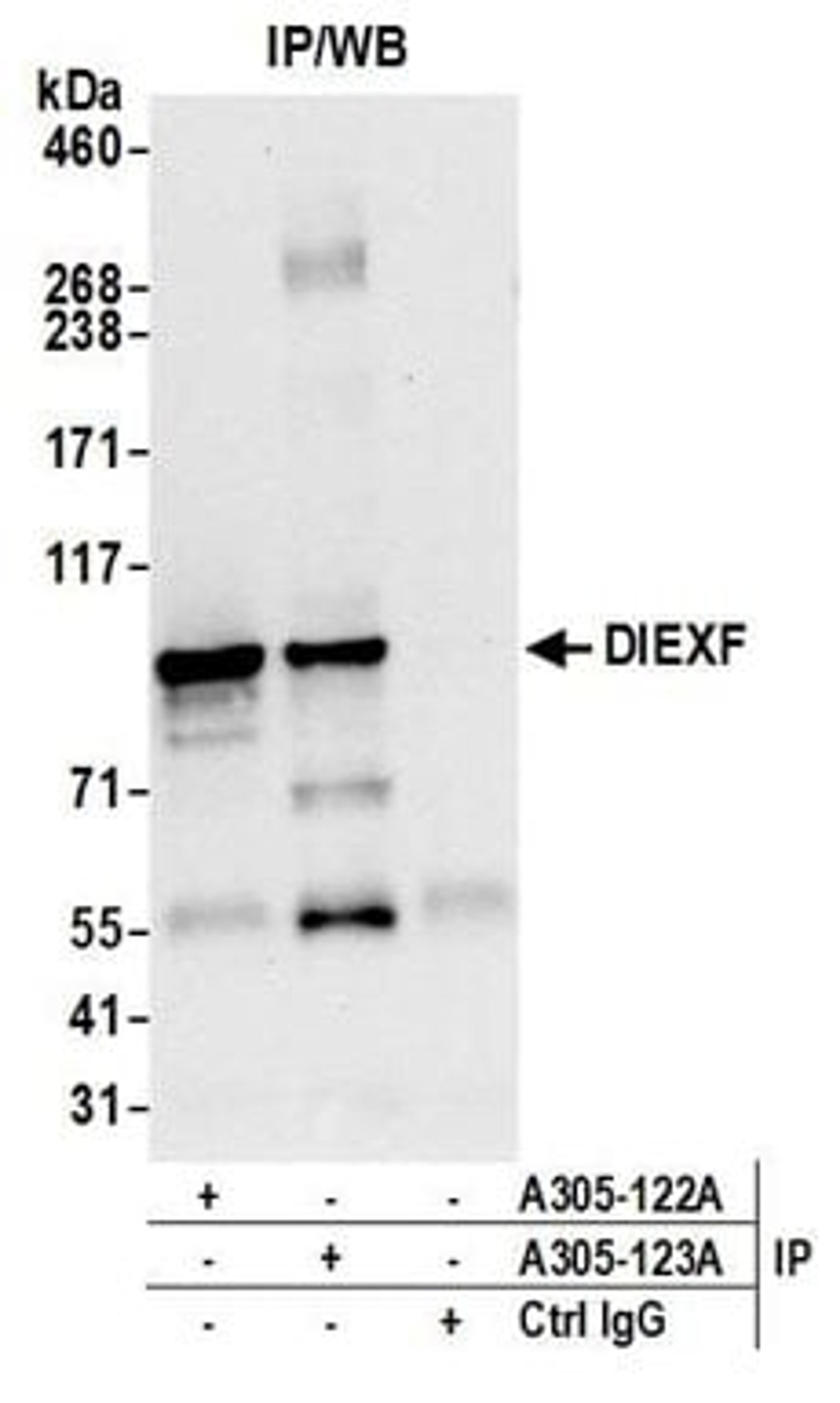 Detection of human DIEXF by western blot of immunoprecipitates.