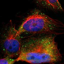 Immunocytochemistry/Immunofluorescence: COL14A1 Antibody [NBP1-86877] - Immunofluorescent staining of human cell line U-251MG shows positivity in vesicles.