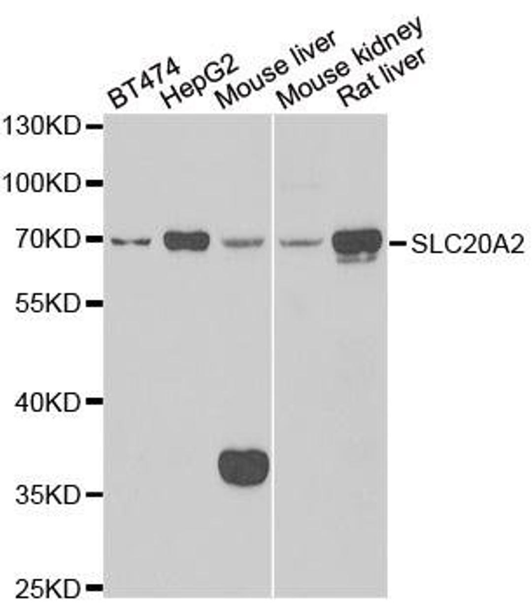 Western blot analysis of extracts of various cell lines using SLC20A2 antibody